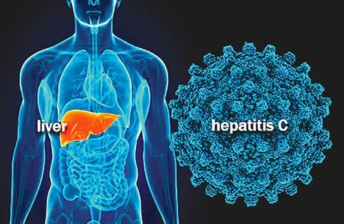 Hepatitis C virus jpg