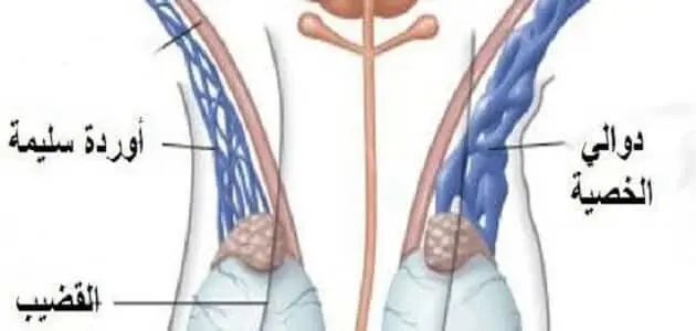 علاج الدوالي الخصية اليسرى jpg